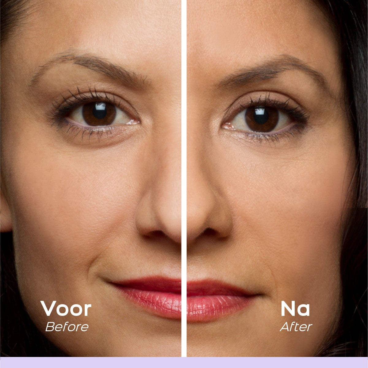 Eyelid Lift Stickers with Gel – Hypoallergenic, Clear