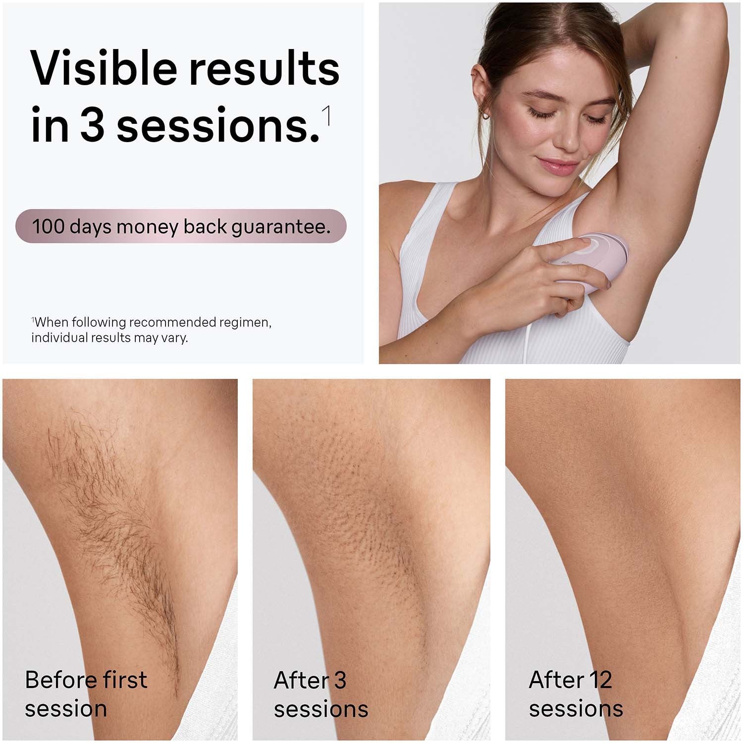 IPL Hair Removal Device for Home Use – Long-Lasting Smooth Skin