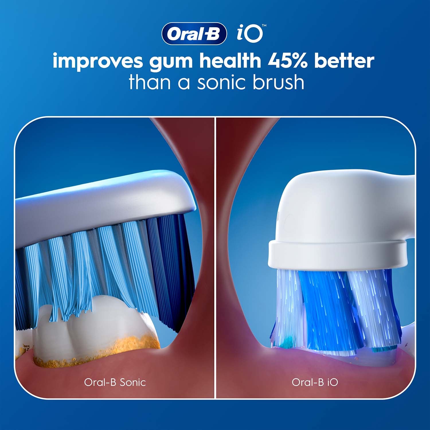 Electric Toothbrush with Whitening, 3 Modes, Pressure Sensor