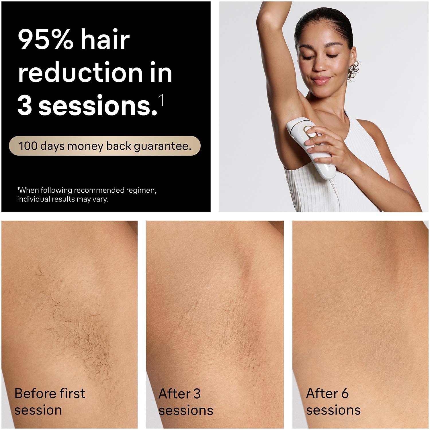 IPL Hair Removal Device, Home Use, 2 Heads, Long-Lasting Results